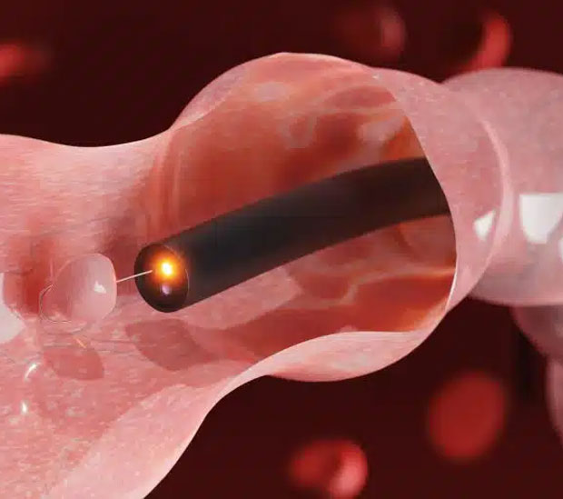 Forest Hills Gastroenterologist