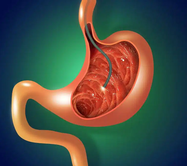 Forest Hills Gastroenterologist